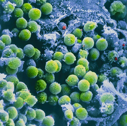 Image: False-color scanning electron micrograph of the cortex of a thymus, showing T-lymphocytes that are vital to the cell-mediated response of the immune system (Photo courtesy of CNRI / SPL).